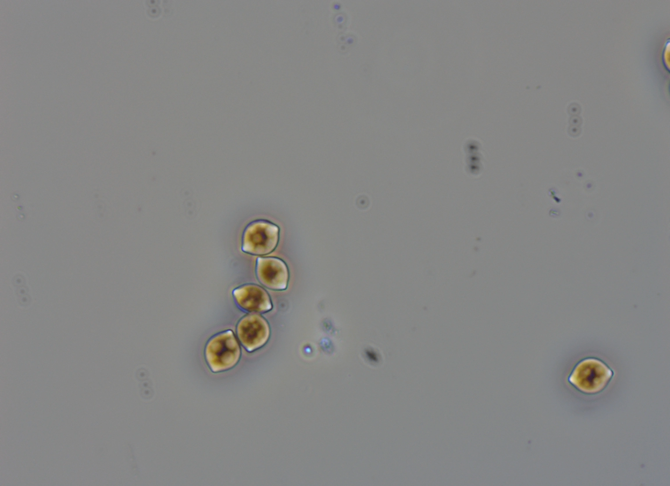 Ekte sekksporesopper: Chaetomium hungaricum.