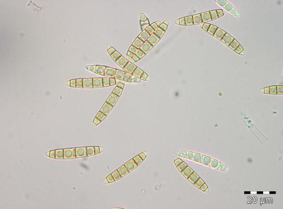 Ekte sekksporesopper: Umbrinosphaeria caesariata.